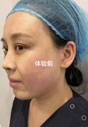 点击看大图 体验前-脸博士医疗美容·眼鼻整形·抗衰中心