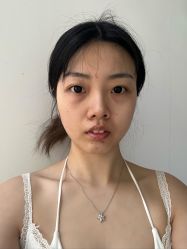 -成都西区医院整形美容