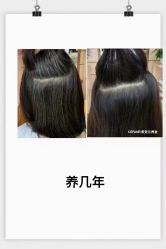 -希梵尔头皮抗衰·科技养发