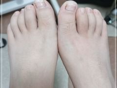 -世龙世家灰指甲鸡眼脚气甲沟炎跖疣护理(通州店)