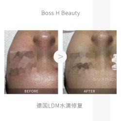 -Boss H Beauty美肌中心