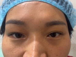 -安徽合肥韩美整形外科医院