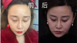 -和颜一美轻医美连锁