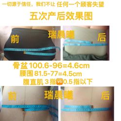 -瑞晨曦催乳产后健康(枣园店)