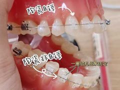 -团圆口腔·种植中心(锦江院区)