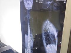 -张钰强中医正骨推拿连锁(华发商都店)