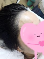 -变美丽半永久纹眉连锁·机器野生眉·洗眉