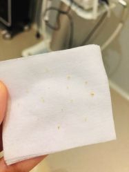 -苑苑vbeauty科技美容SPA