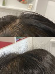-舒欣头疗·俏丝谧语 白发脱发专业护理 