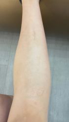 体验后-美莱医学美容医院