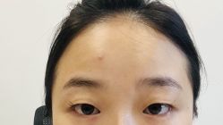 -素美医疗美容·西南眼鼻整形·修复基地