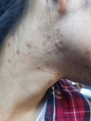 -安那般那皮肤年轻化ANAPANA