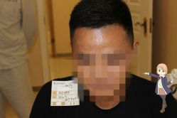 -大麦微针植发丨全国连锁