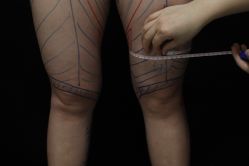 -禾美嘉医疗美容