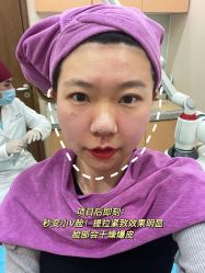 -北京米扬丽格医疗美容·联合丽格鼻整形中心