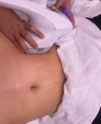 -Lily纤美·科技减脂中心