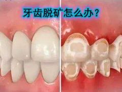 -团圆口腔·种植中心(锦江院区)
