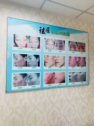 -苗方清颜专业祛痘连锁机构