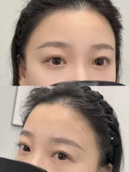 点击看大图 -张小野·专业半永久纹眉