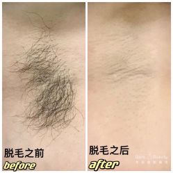 -植蔻妍倍儿专业脱毛·皮肤管理