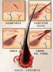 -希梵尔头皮抗衰·科技养发