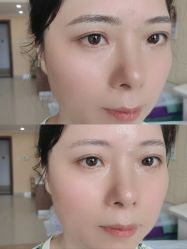 -西施无菌半永久纹绣眉眼影唇轻增发纹发际线