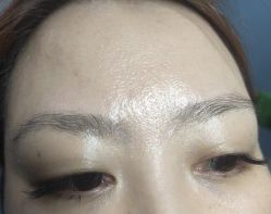 -北京美痣堂古方祛痣斑疣瘊