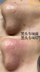 -skin79皮肤管理中心