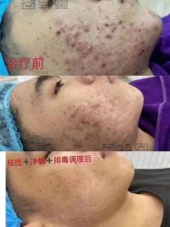 -蕾特恩专业祛痘·皮肤管理
