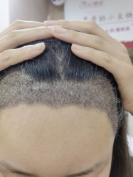 -熙朵美学植发·连锁品牌