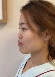 -北京米扬丽格医疗美容·联合丽格鼻整形中心