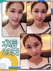 -广东韩妃整形外科医院