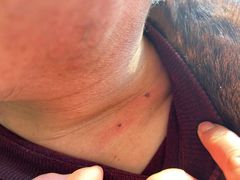 -杭州市第三人民医院