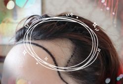 -大麦微针植发全国连锁