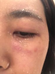 -新美荟医美·专注面部美学抗衰