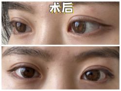 -素美医疗美容·西南眼鼻整形·修复基地