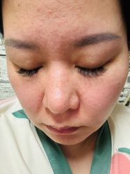 体验前-佳妍惠美科技美肤美体中心