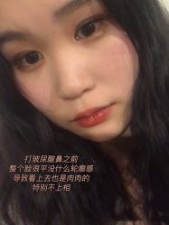 -Yestar宁波艺星整形医院