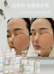 -春田皮肤管理中心品牌旗舰店