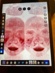 点击看大图 -宥莉·ULLY 痘敏肌•科技皮肤管理中心