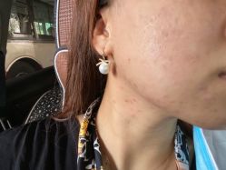 -苗方清颜痘肌研究所