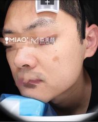 -韩国淼美颜皮肤管理官方直营店