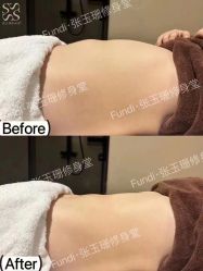 -Fundi张玉珊修身堂·indiba·BTL科技瘦身