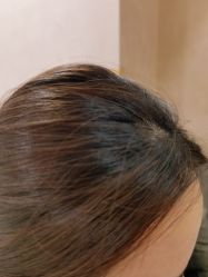 -熙朵美学植发·连锁品牌