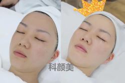 -美肤盾祛痘·问题肌头疗管理中心