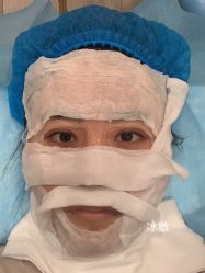 体验后-上海时光整形外科医院