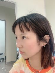 体验后-北京丽星翼美医疗美容