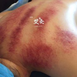 -御森堂. 中医养生. 美容按摩