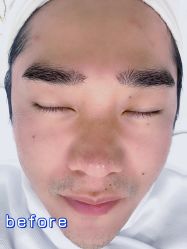 -SKIN79皮肤管理中心