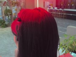 -碧莲盛·不剃发植发